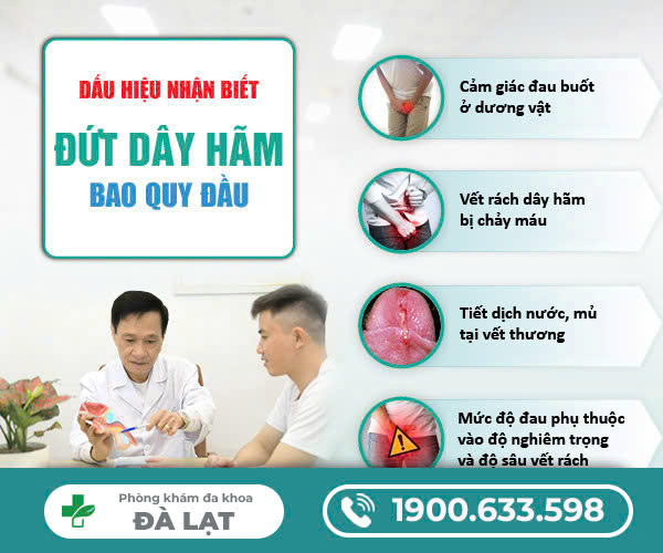 Hình ảnh minh họa